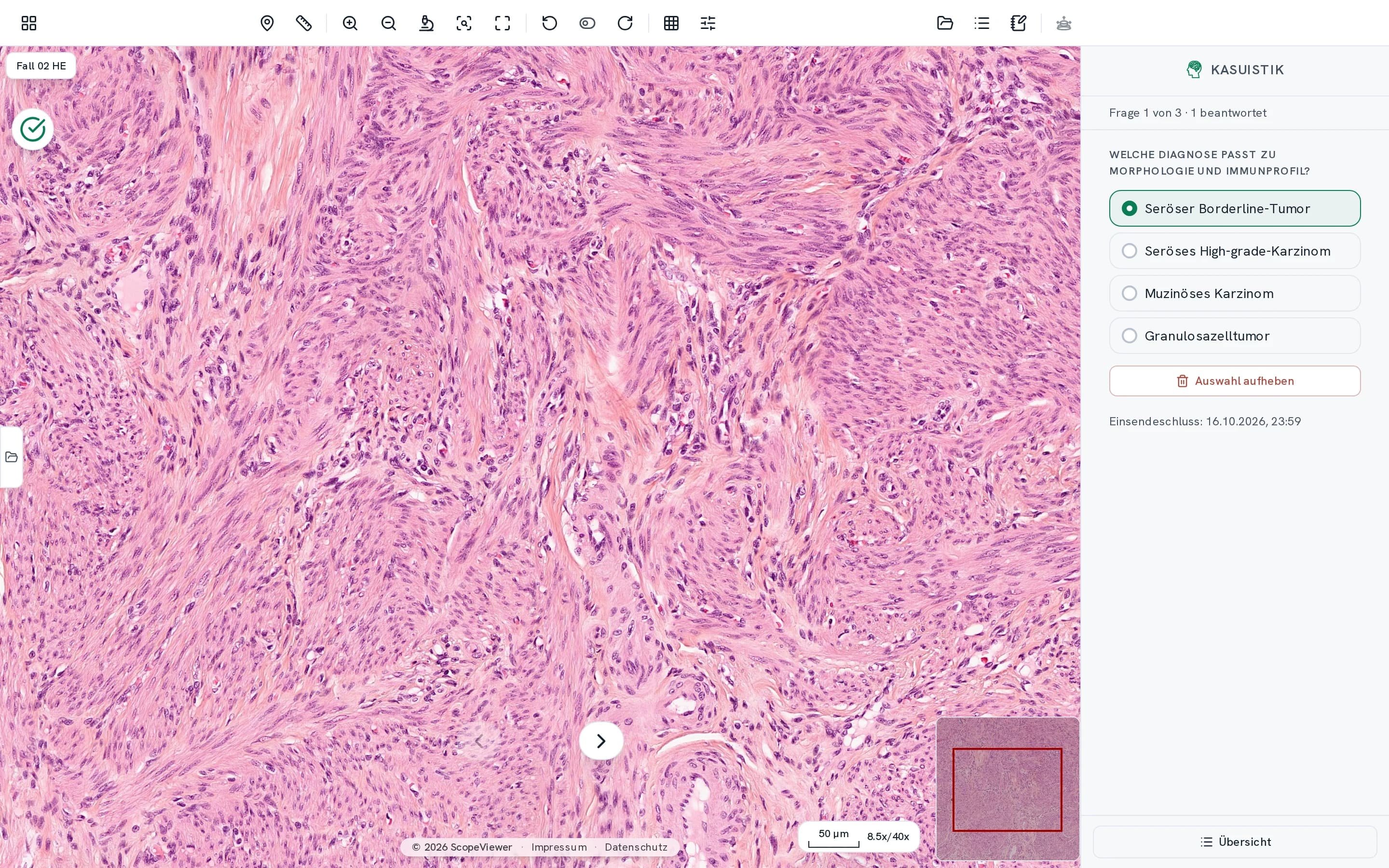 A case study on the desktop, the case question with its answer options docked beside the section