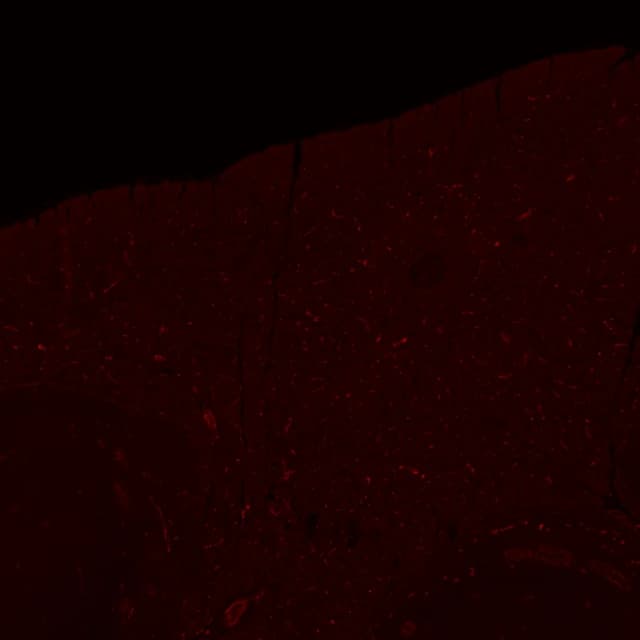 The same field in the Cy3 channel alone, scattered red signals in the tissue