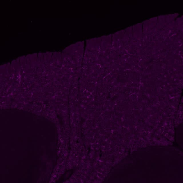 The same field in the Cy5 channel alone, the tissue glowing magenta