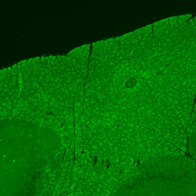 The same field in the FITC channel alone, the epithelium glowing green