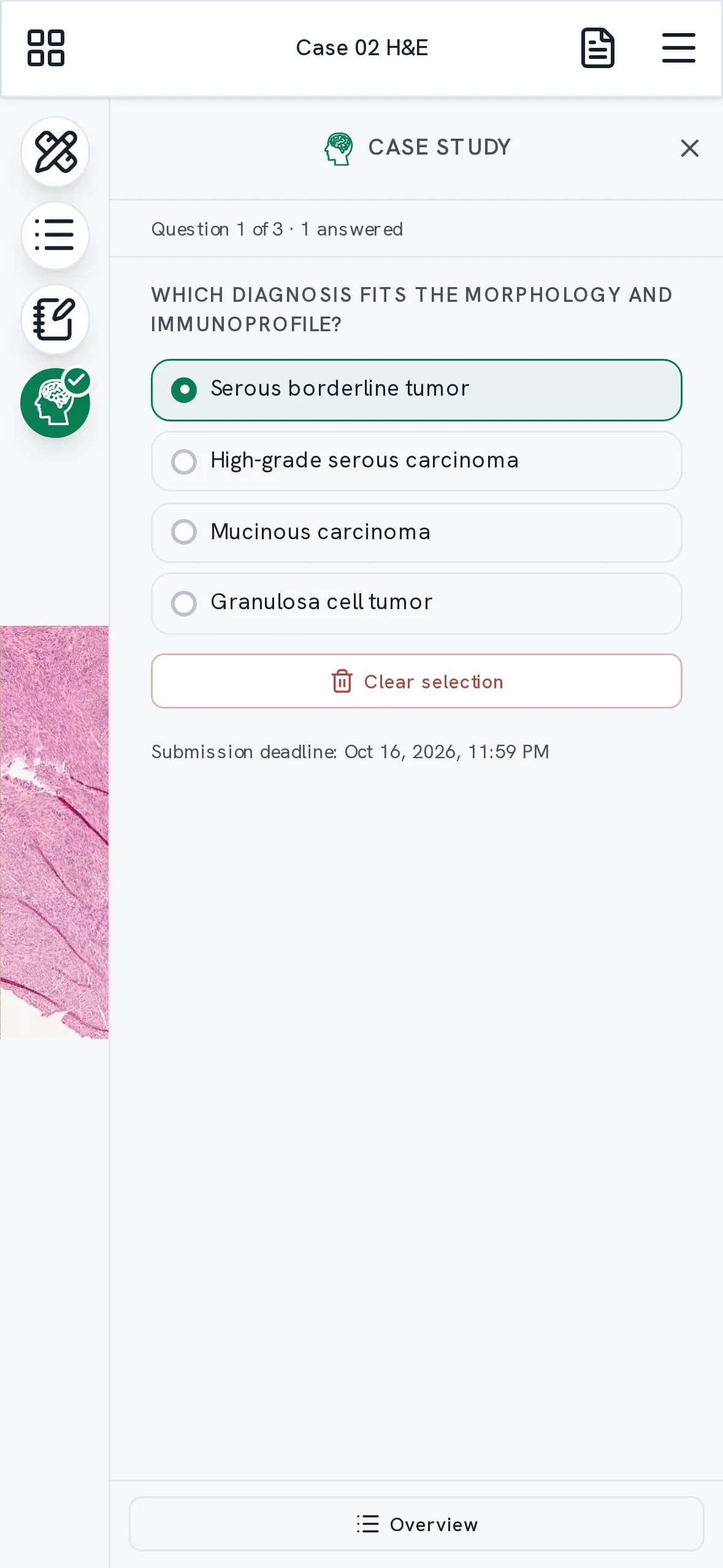 A case question on a phone beside the section, with answer options and a deadline