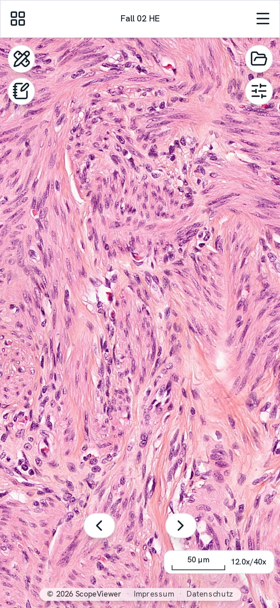 A section on a phone at 12x magnification, with a scale bar