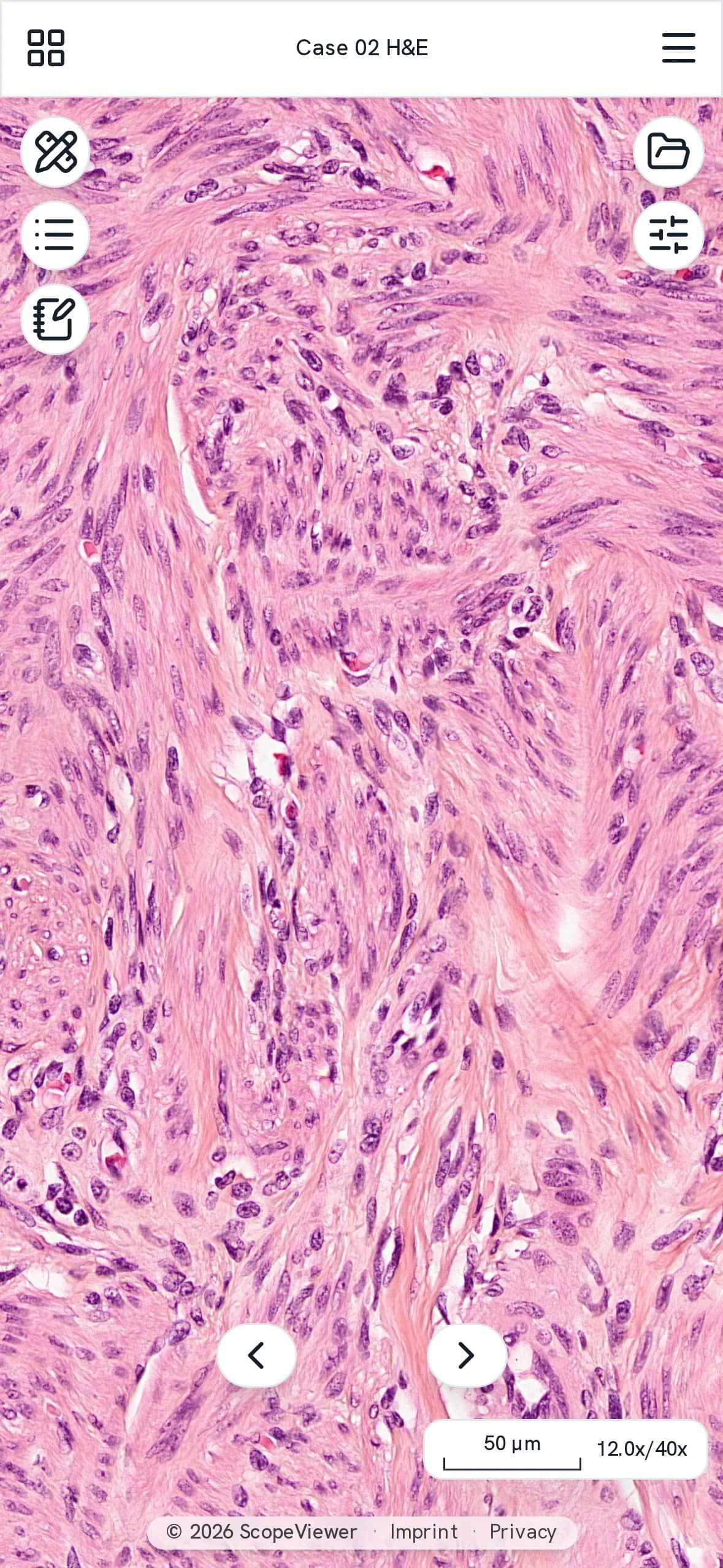 A section on a phone at 12x magnification, with a scale bar