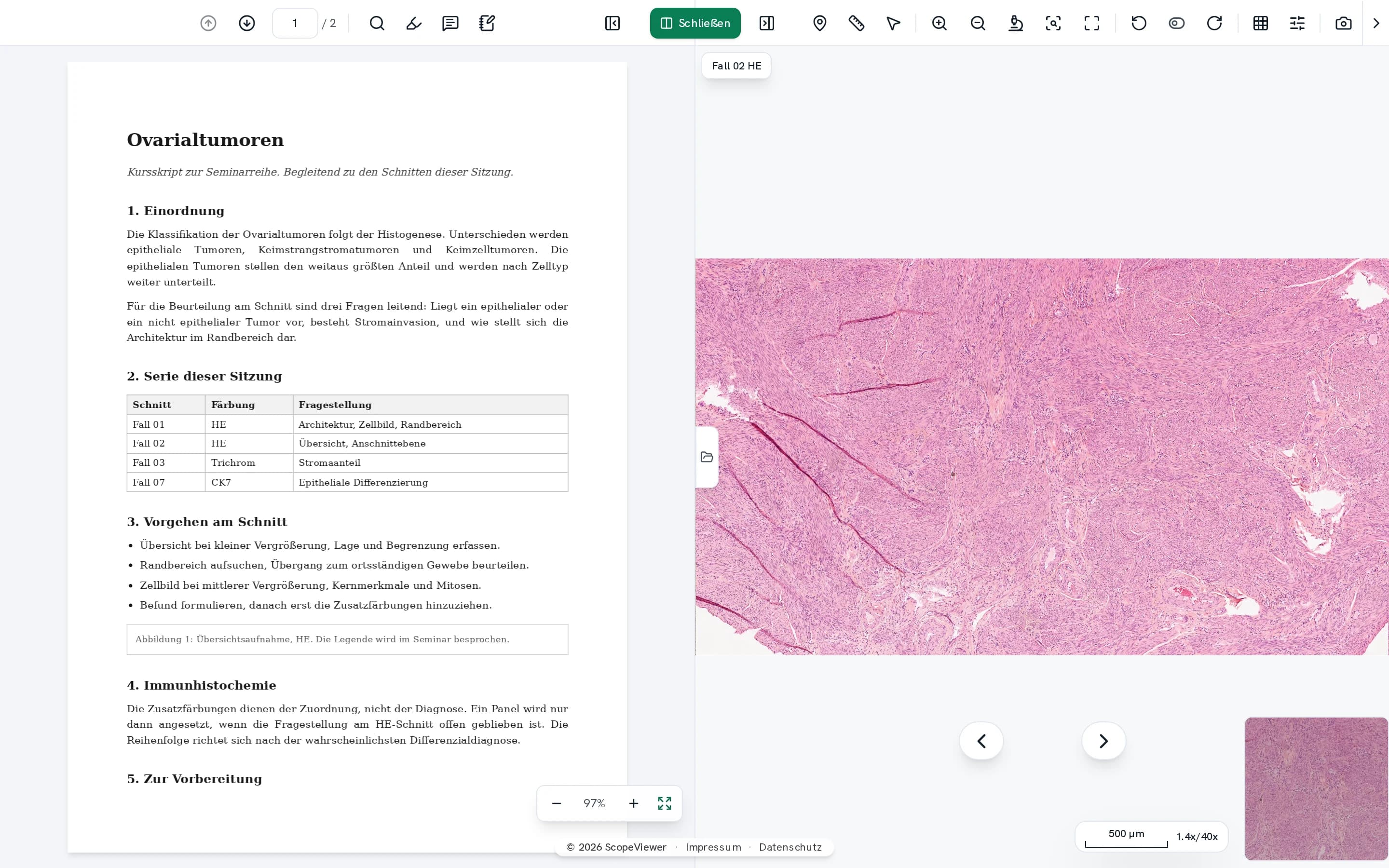 Split window with the handout on the left and the section at full resolution on the right
