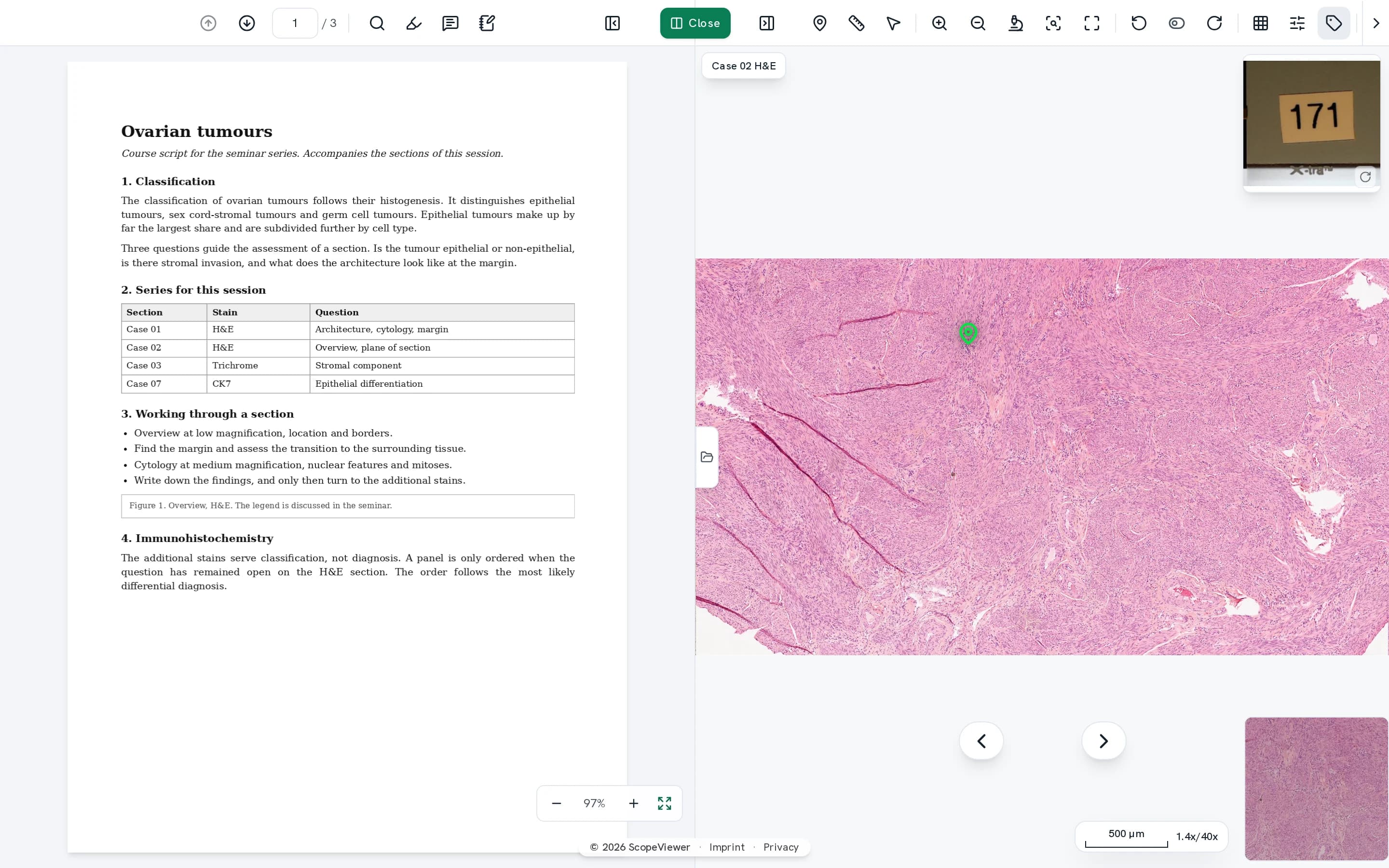 Split window with the handout on the left and the section at full resolution on the right